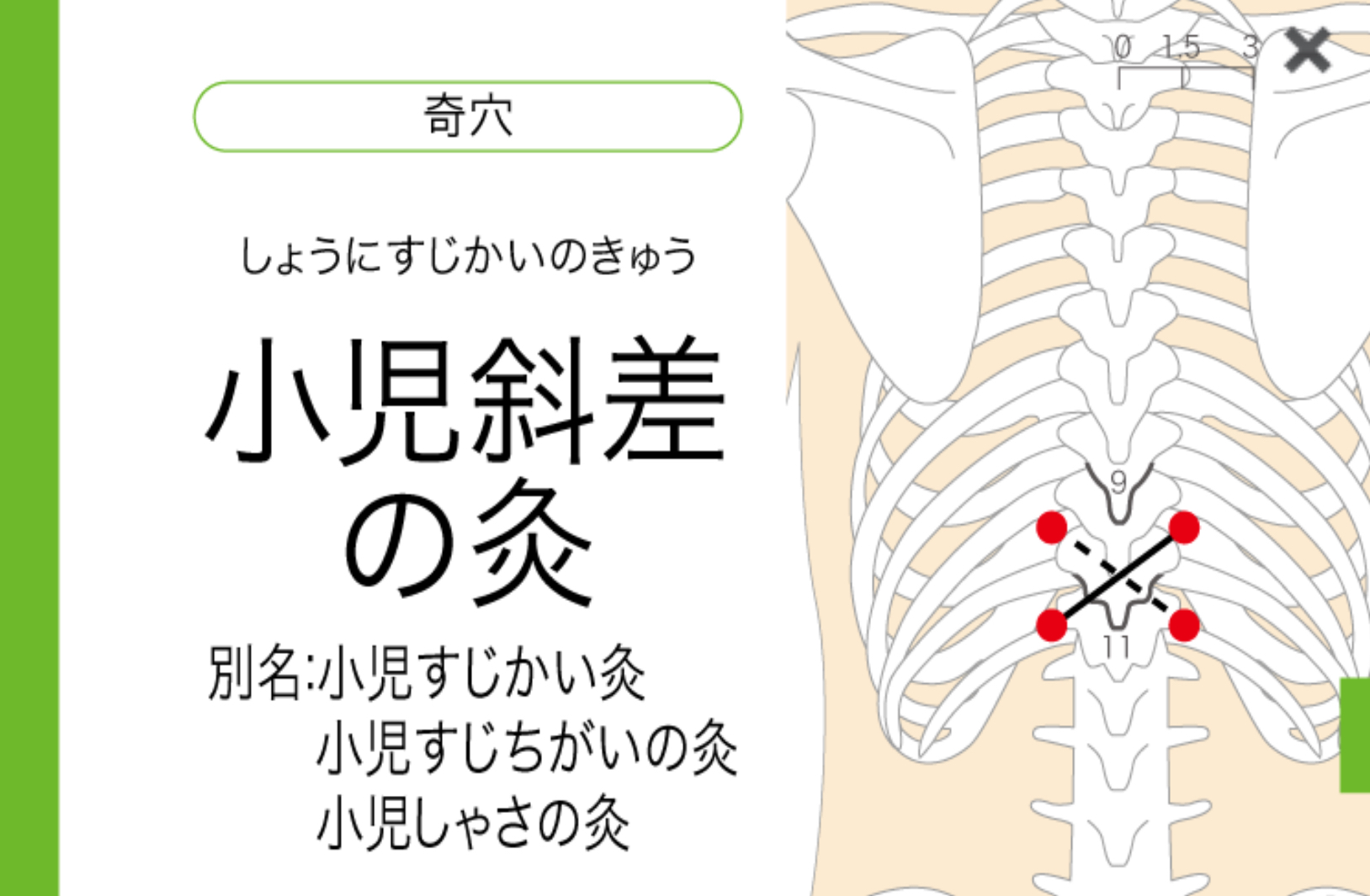 背中の痛みの部位