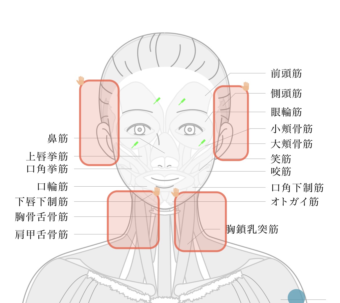 治療部位のイラスト