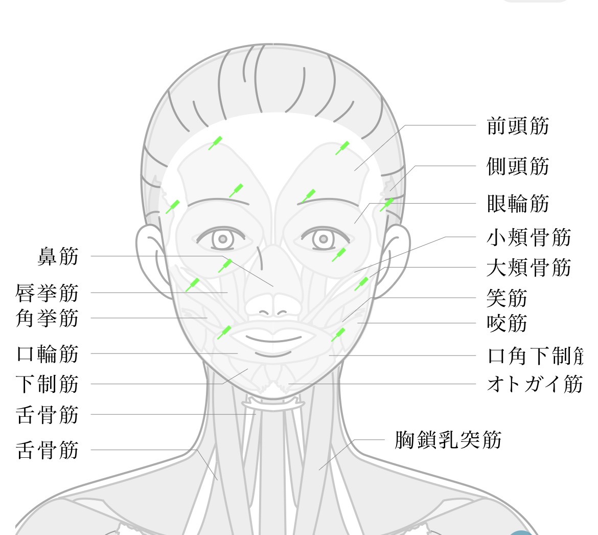 美容鍼のイラスト