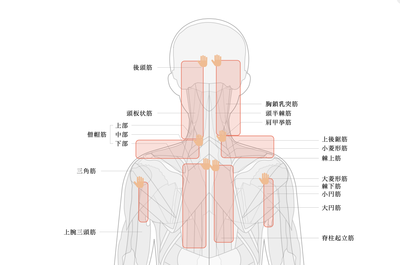極度の首肩こりを発生させる筋肉の部位を示したイラスト