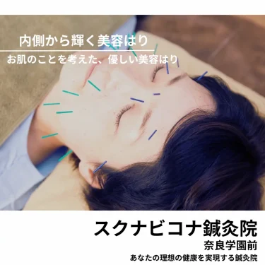 美容鍼写真