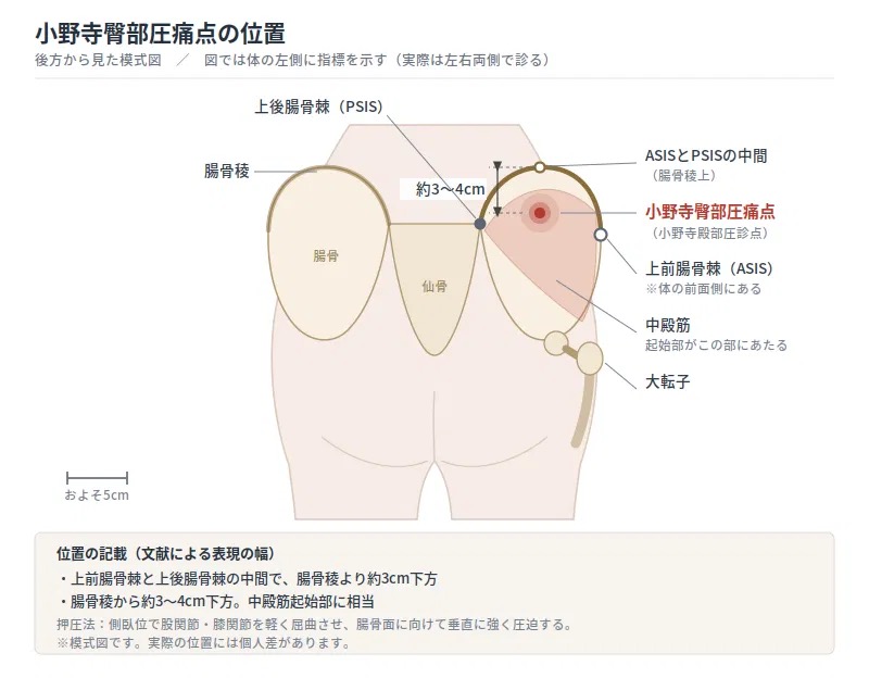 小野寺圧痛点のイラスト